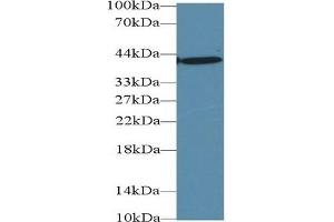 Detection of AST in Human Liver lysate using Monoclonal Antibody to Aspartate Aminotransferase (AST)