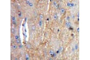 IHC-P analysis of Brain tissue, with DAB staining. (C1QA anticorps  (AA 23-245))