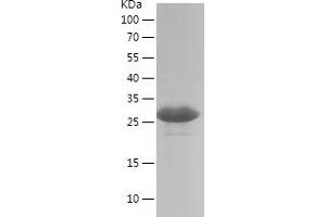 Western Blotting (WB) image for Ets Variant 5 (ETV5) (AA 1-200) protein (His tag) (ABIN7122825)