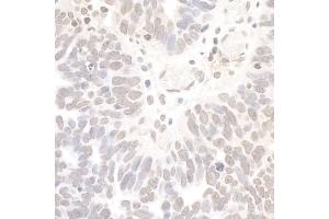 Immunohistochemistry (IHC) image for anti-RE1-Silencing Transcription Factor (REST) (AA 800-850) antibody (ABIN7454366)