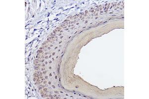 Immunohistochemistry of paraffin-embedded Mouse skin using SSC/SerpinB3 Rabbit mAb (ABIN7270242) at dilution of 1:100 (40x lens). (SERPINB3 anticorps)