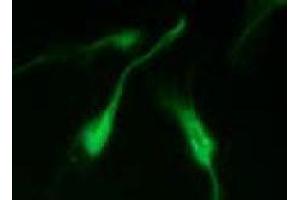 Immunofluorescence (IF) image for anti-Vimentin (VIM) (pSer50) antibody (ABIN1449160)