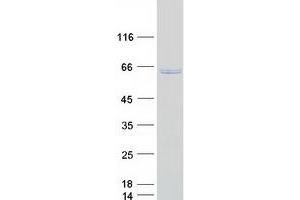 Validation with Western Blot