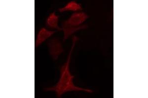 ABIN6274776 staining A549 cells by IF/ICC.