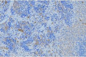 ABIN6277157 at 1/100 staining Human lymph node tissue by IHC-P. (KRT17 anticorps  (C-Term))