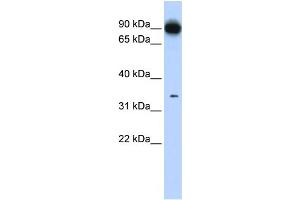 WB Suggested Anti-PRKRA Antibody Titration: 0.