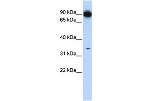 WB Suggested Anti-PRKRA Antibody Titration: 0. (PRKRA anticorps  (N-Term))