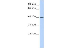 WB Suggested Anti-C11orf65 Antibody Titration: 0. (C11orf65 anticorps  (N-Term))
