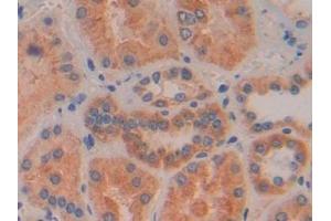Detection of IFNb in Human Kidney Tissue using Polyclonal Antibody to Interferon Beta (IFNb)