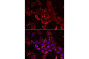 Immunofluorescence analysis of U2OS cells using MYOT antibody (ABIN5973839). (Myotilin anticorps)