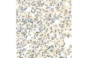 Immunohistochemistry of paraffin embedded rat lung using Thymosin (ABIN7075306) at dilution of 1:1500 (400x lens) (PTMA anticorps)