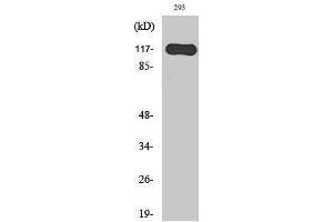 Western Blotting (WB) image for anti-Hairless (HR) (N-Term) antibody (ABIN3175456) (Hairless anticorps  (N-Term))