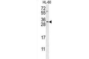 Western Blotting (WB) image for anti-Empty Spiracles Homeobox 2 (EMX2) antibody (ABIN3002378) (EMX2 anticorps)