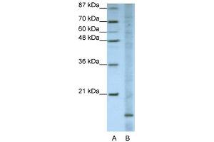 WB Suggested Anti-FAM121B Antibody Titration:  1. (APOO anticorps  (N-Term))