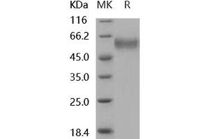 Western Blotting (WB) image for Secreted Frizzled-Related Protein 4 (SFRP4) protein (His tag) (ABIN7320416)