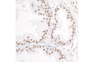 Immunohistochemistry (IHC) image for anti-DEAD (Asp-Glu-Ala-Asp) Box Polypeptide 5 (DDX5) (C-Term) antibody (ABIN7454642) (DDX5 anticorps  (C-Term))