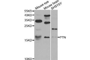 Western blot analysis of extracts of various cell lines, using PTN antibody. (Pleiotrophin anticorps)