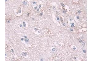 Detection of NELL2 in Human Cerebrum Tissue using Polyclonal Antibody to NEL Like Protein 2 (NELL2)