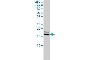 NME1 monoclonal antibody (M01), clone 2H1 Western Blot analysis of NME1 expression in Hela S3 NE .