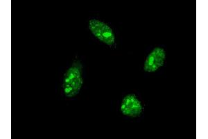 Immunofluorescence of monoclonal antibody to CDX1 on HeLa cell. (CDX1 anticorps  (AA 126-215))