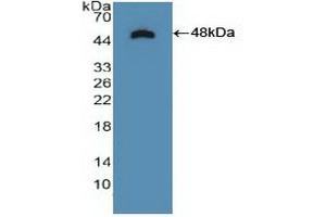 Detection of Recombinant NTRK2, Human using Polyclonal Antibody to Tropomyosin Receptor Kinase B (TrkB)