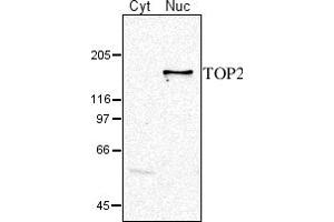 Image no. 1 for anti-DNA Topoisomerase II (TOP2) (C-Term), (N-Term) antibody (ABIN334538) (TOP2 anticorps  (C-Term, N-Term))