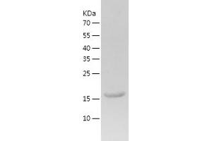 Western Blotting (WB) image for CCHC-Type Zinc Finger, Nucleic Acid Binding Protein (CNBP) (AA 1-170) protein (His-IF2DI Tag) (ABIN7122189)