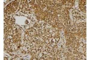 ABIN6273267 at 1/100 staining Human pancreas tissue by IHC-P. (MMP28 anticorps  (Internal Region))
