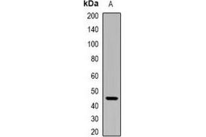 Western blot analysis of Ikaros expression in BT474 (A) whole cell lysates. (IKZF1 anticorps)