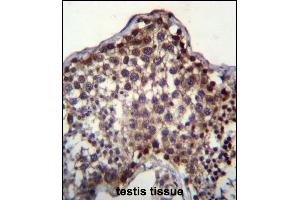 anti-PQ Loop Repeat Containing 2 (PQLC2) (AA 222-251), (C-Term) antibody