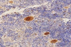 Immunohistochemistry analysis of paraffin-embedded mouse bone using,TMEM177 (ABIN7075996) at dilution of 1: 1000 (TMEM177 anticorps)