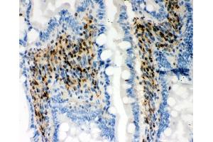 IHC analysis of RUNX3 using anti-RUNX3 antibody (ABIN3043318). (RUNX1 anticorps  (Middle Region))