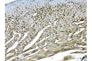 IHC analysis of Laminin using anti-Laminin antibody .