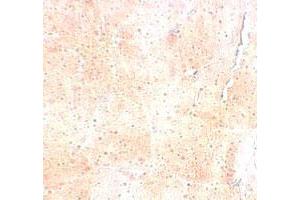 Immunohistochemical staining of mouse skeletal muscle cells with SYNPO2 polyclonal antibody  at 5 ug/mL. (SYNPO2 anticorps  (N-Term))