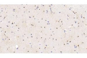 Detection of S100 in Bovine Cerebrum Tissue using Polyclonal Antibody to S100 Calcium Binding Protein (S100) (S100 Protein (S100) (AA 1-94) anticorps)