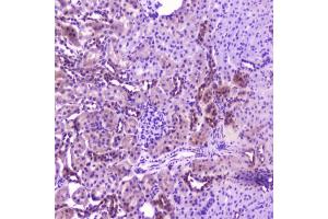 IHC testing of FFPE rat kidney with IL36A antibody at 2ug/ml. (IL36A/IL1F6 anticorps  (AA 6-151))