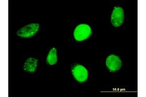 Immunofluorescence of monoclonal antibody to SP110 on HeLa cell.