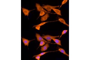 Immunofluorescence analysis of PC-12 cells using IDS Rabbit pAb (ABIN3015633, ABIN3015634, ABIN3015635 and ABIN6218988) at dilution of 1:25 (40x lens).