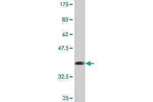 Western Blot detection against Immunogen (37.