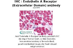 Image no. 1 for anti-Endothelin Receptor Type A (EDNRA) (2nd Extracellular Domain) antibody (ABIN1734026)