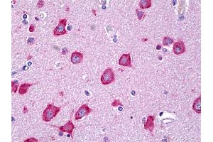 Anti-MLKL antibody IHC of human brain, cortex neurons. (MLKL anticorps  (AA 371-472))