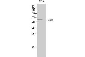 Western Blotting (WB) image for anti-C-terminal Binding Protein 2 (CTBP2) (C-Term) antibody (ABIN3174596) (CTBP2 anticorps  (C-Term))