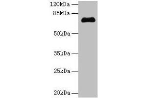 Western blot All lanes: PMEL antibody at 14 μg/mL + Jurkat whole cell lysate Secondary Goat polyclonal to rabbit IgG at 1/10000 dilution Predicted band size: 71, 61, 67 kDa Observed band size: 71 kDa