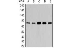 Western blot analysis of PAIP1 expression in HepG2 (A), A549 (B), mouse liver (C), mouse kidney (D), rat brain (E) whole cell lysates. (PAIP1 anticorps)