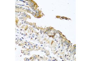 Immunohistochemistry of paraffin-embedded mouse lung using RNASE11 antibody at dilution of 1:100 (40x lens). (RNASE11 anticorps)