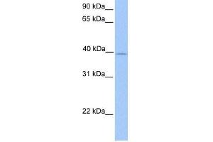 ZFP92 antibody used at 0. (ZNF92 anticorps  (Middle Region))