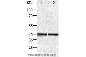 Western blot analysis of Hela and Jurkat cell, using PDX1 Polyclonal Antibody at dilution of 1:450 (PDX1 anticorps)