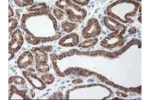 anti-Ribophorin 1 (RPN1) antibody