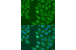 Immunofluorescence analysis of U2OS cells using HSD17B3 antibody (ABIN2736919) at dilution of 1:100. (HSD17B3 anticorps)