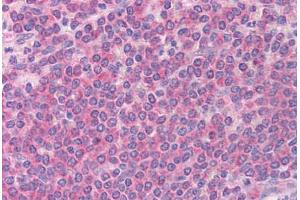 Human Spleen (formalin-fixed, paraffin-embedded) stained with BCL2L11 antibody ABIN213909 at 5 ug/ml followed by biotinylated goat anti-rabbit IgG secondary antibody ABIN481713, alkaline phosphatase-streptavidin and chromogen. (BIM anticorps  (Internal Region))